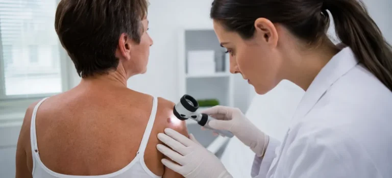 Tumori cutanate: cum le recunoști, când este necesară evaluarea medicală și ce opțiuni de tratament există